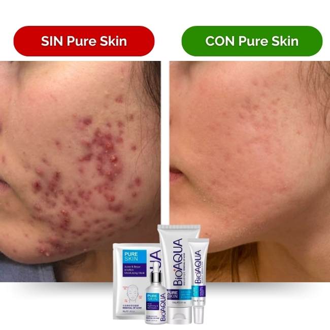Pure skin kit BioAqua